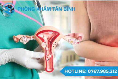  Top 3 địa chỉ khám phụ khoa uy tín tại Kon Tum